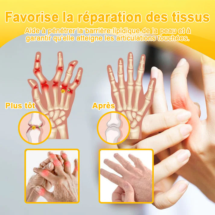 ODALIT® Crème de guérison des os et de soulagement de la douleur au Botox et venin d'abeille