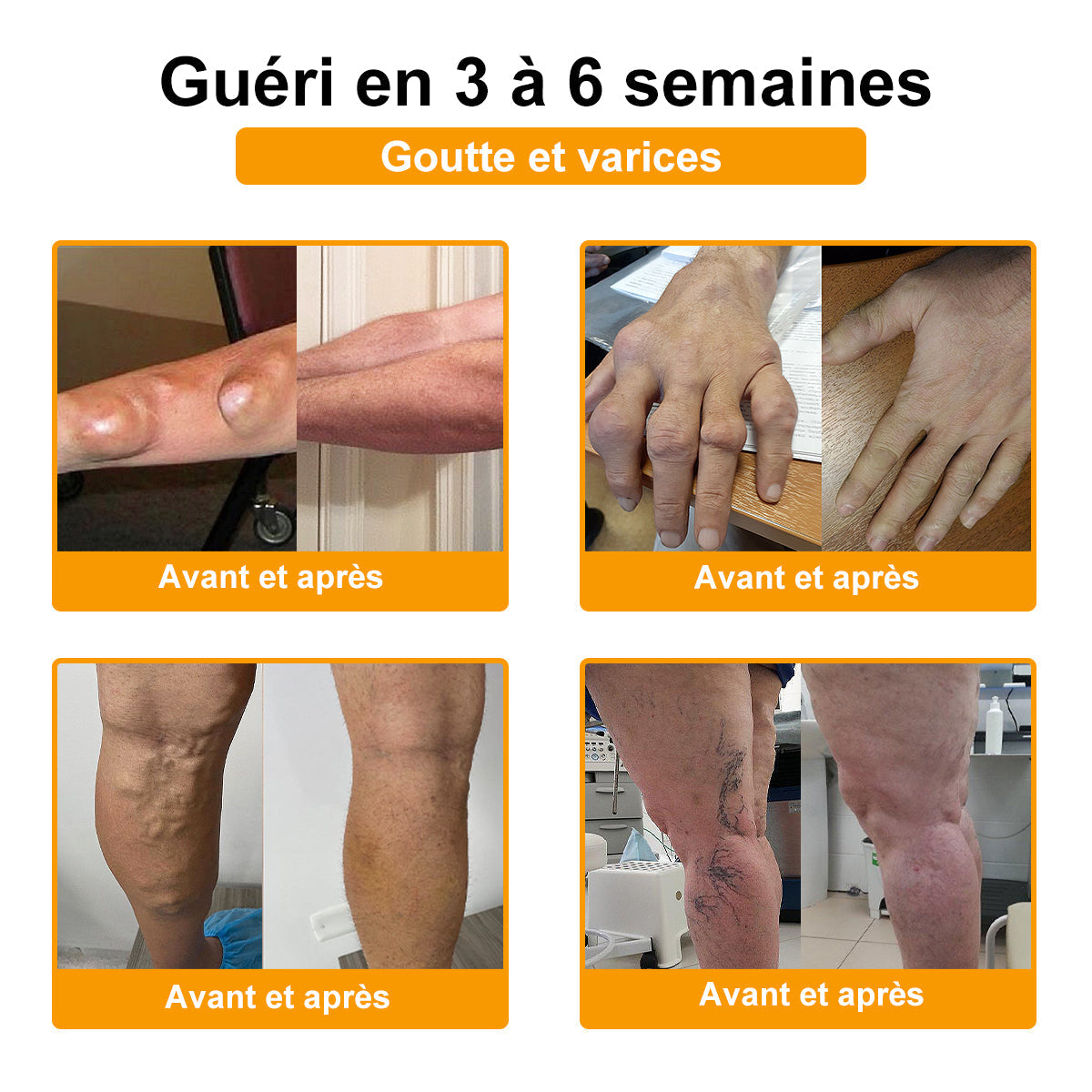ODALIT® Crème de guérison des os et de soulagement de la douleur au Botox et venin d'abeille