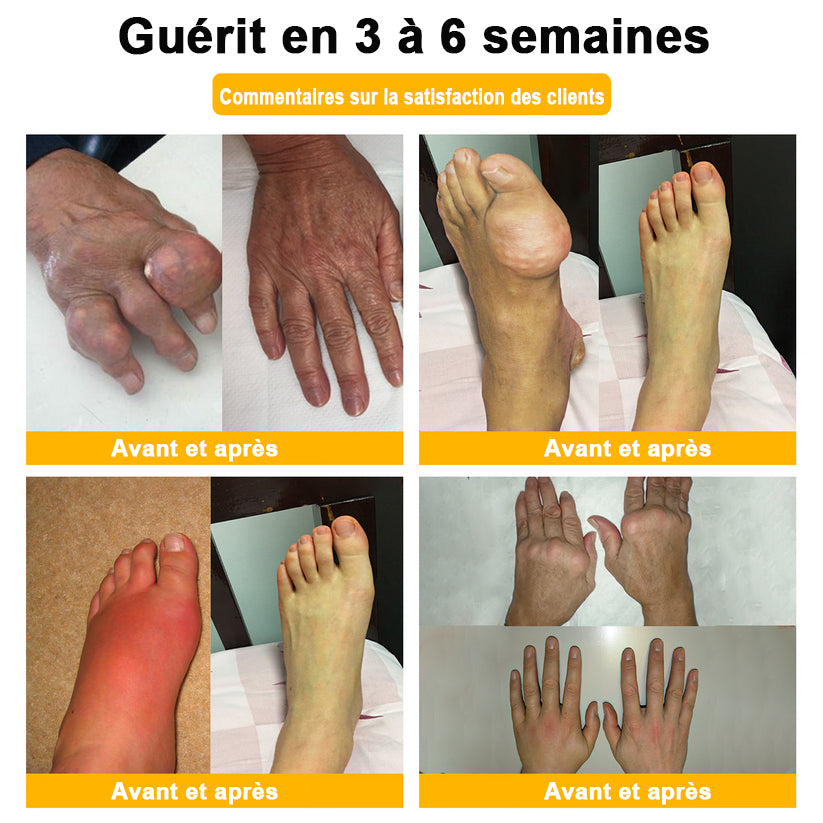 ODALIT® Crème de guérison des os et de soulagement de la douleur au Botox et venin d'abeille
