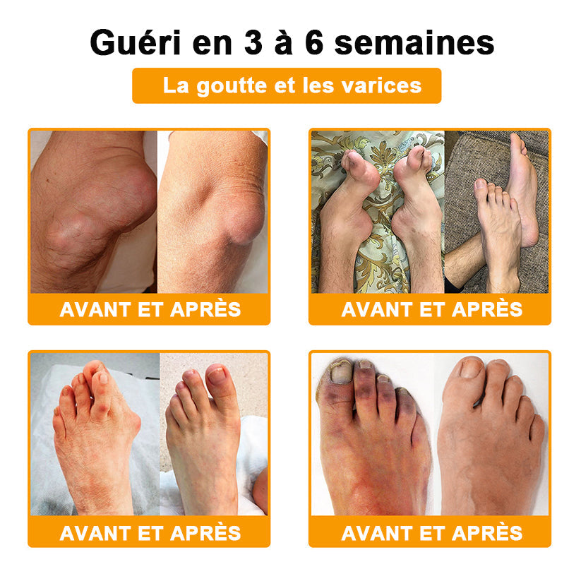 ODALIT® Crème de guérison des os et de soulagement de la douleur au Botox et venin d'abeille