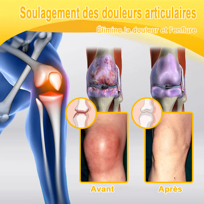 ODALIT® Crème de guérison des os et de soulagement de la douleur au Botox et venin d'abeille