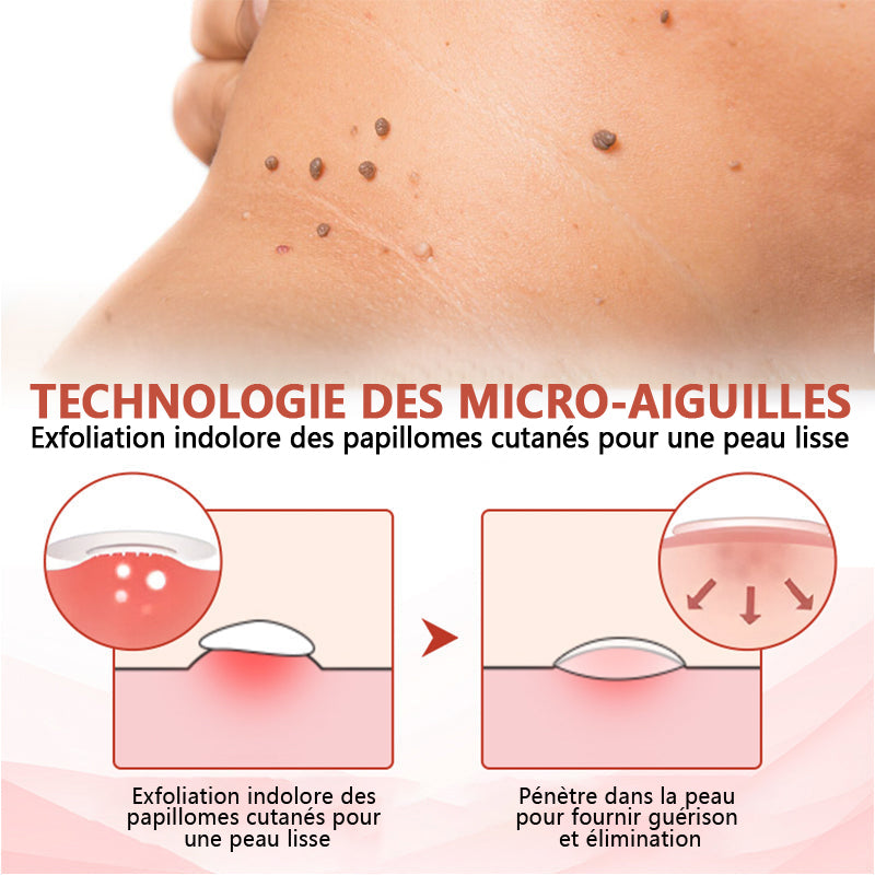 🔥ODALIT™Le patch sans douleur, ultra-efficace🔥