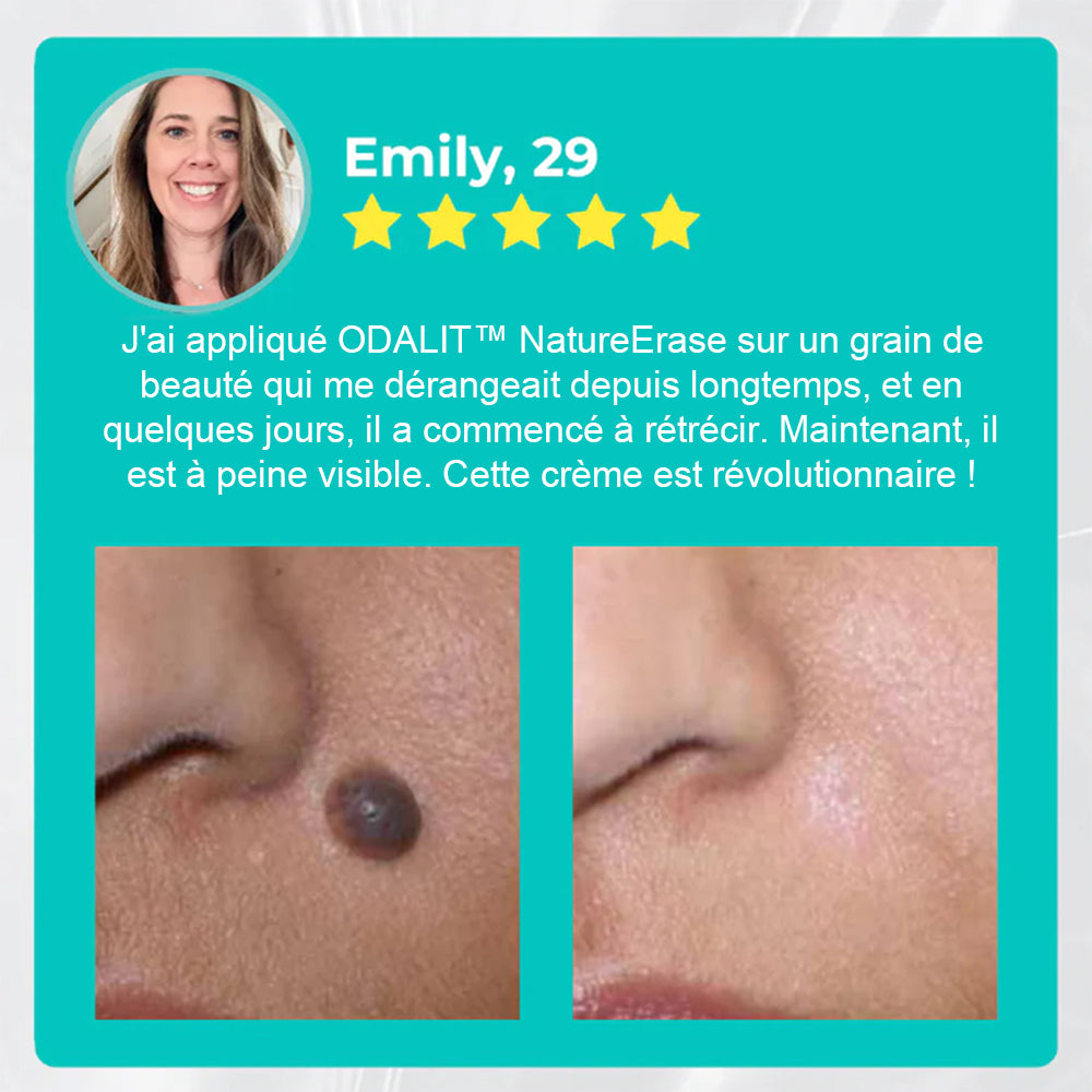 ✅Boutique officielle : Gel ODALIT™ Nature Erase – Élimination instantanée des grains de beauté et taches