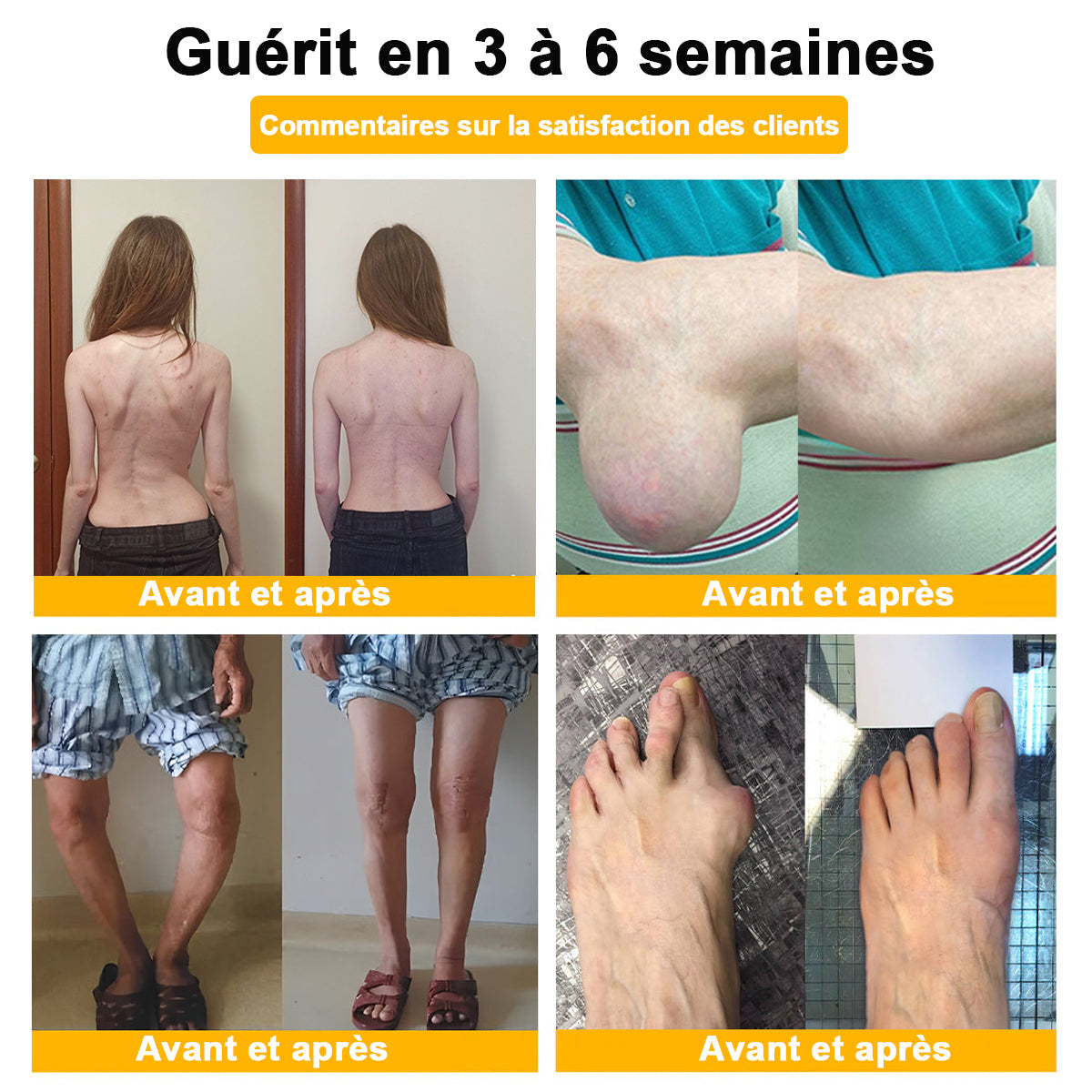 ODALIT®  Crème de guérison des os et de soulagement de la douleur au Botox et venin d'abeille