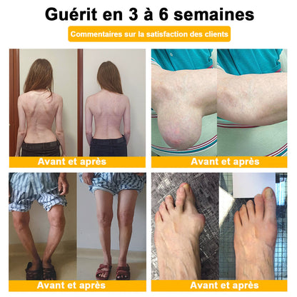 ODALIT®  Crème de guérison des os et de soulagement de la douleur au Botox et venin d'abeille