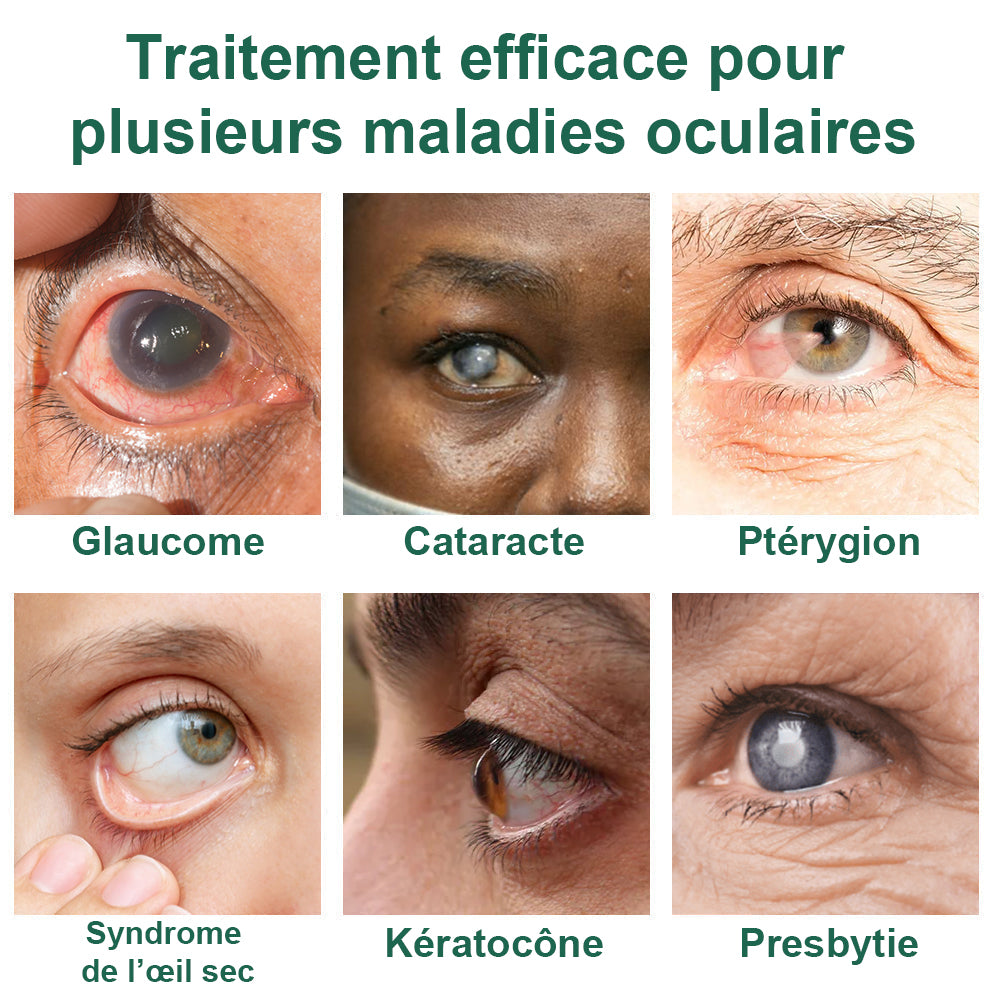 👩‍⚕️ODALIT™ Nano Sérum Gouttes Oculaires ✅Approuvé par la FDA (Convient à la presbytie, au syndrome de l'œil sec, au glaucome et à la cataracte) ☘️☘️