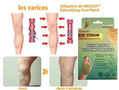 NEGUSY™ LymphTox Patches de Venin d'Abeille pour les Pieds