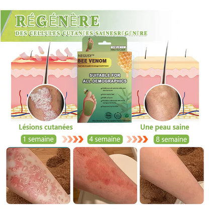 NEGUSY™ LymphTox Patches de Venin d'Abeille pour les Pieds