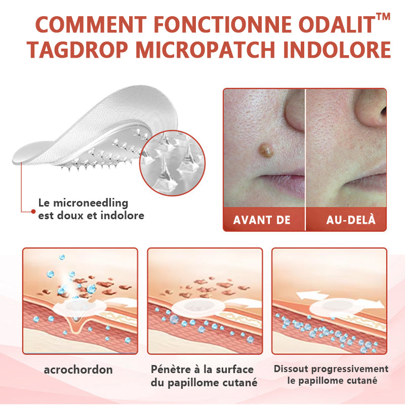 🔥ODALIT™Le patch sans douleur, ultra-efficace🔥