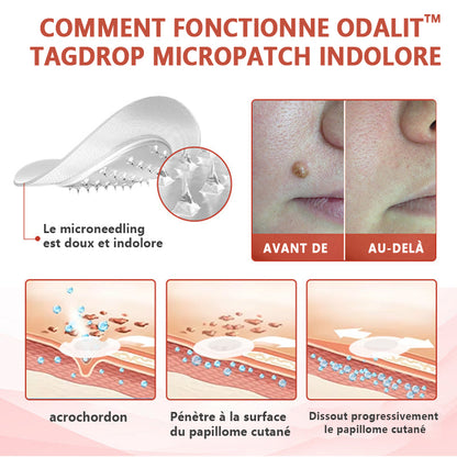 🔥ODALIT™Le patch sans douleur, ultra-efficace🔥