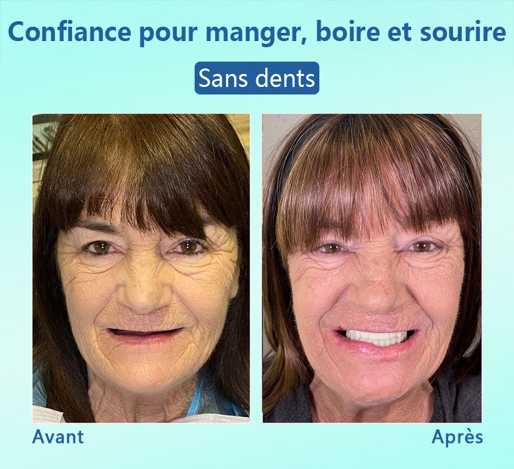 🦷DIYSTAR™ 🍀 𝐏𝐫𝐨𝐭𝐡𝐞̀𝐬𝐞 𝐃𝐞𝐧𝐭𝐚𝐢𝐫𝐞 𝐇𝐚𝐮𝐭 𝐝𝐞 𝐆𝐚𝐦𝐦𝐞 (🦷 Remise limitée dans le temps — dernières 30 minutes ! 🦷)