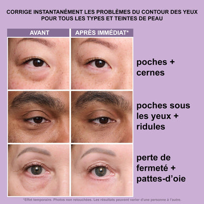 💥DERNIER JOUR : -49% sur le No-Filter Eye Tightener