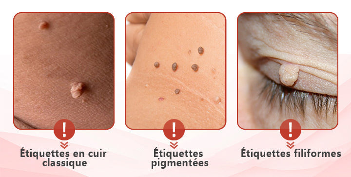 🔥ODALIT™Le patch sans douleur, ultra-efficace🔥