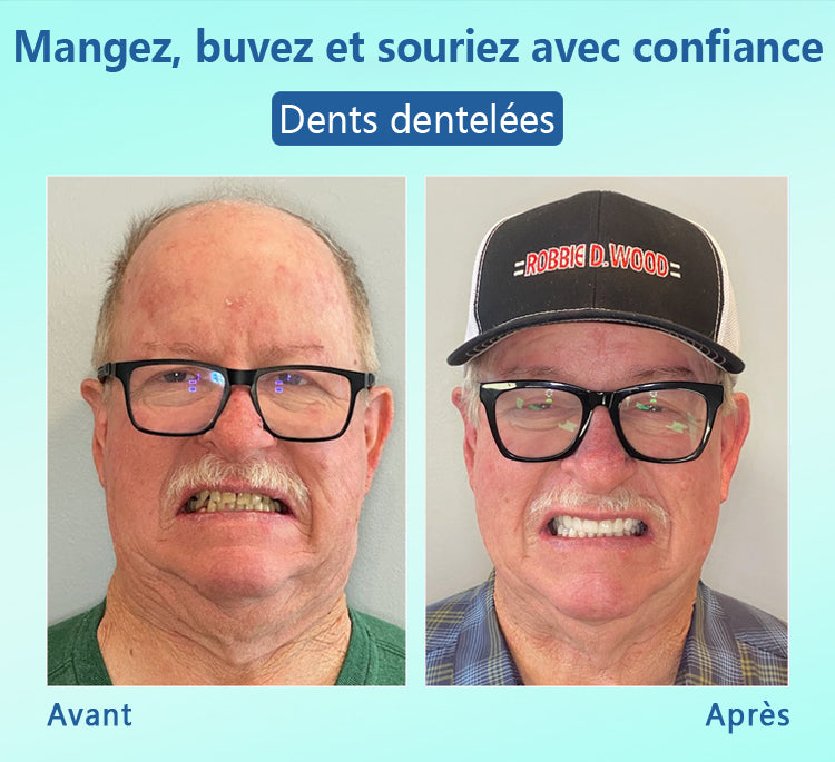 🦷DIYSTAR™ 🍀 𝐏𝐫𝐨𝐭𝐡𝐞̀𝐬𝐞 𝐃𝐞𝐧𝐭𝐚𝐢𝐫𝐞 𝐇𝐚𝐮𝐭 𝐝𝐞 𝐆𝐚𝐦𝐦𝐞 (🦷 Remise limitée dans le temps — dernières 30 minutes ! 🦷)