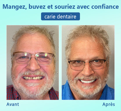 🦷DIYSTAR™ 🍀 𝐏𝐫𝐨𝐭𝐡𝐞̀𝐬𝐞 𝐃𝐞𝐧𝐭𝐚𝐢𝐫𝐞 𝐇𝐚𝐮𝐭 𝐝𝐞 𝐆𝐚𝐦𝐦𝐞 (🦷 Remise limitée dans le temps — dernières 30 minutes ! 🦷)