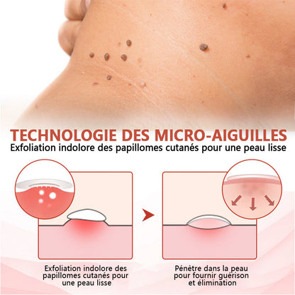 🔥ODALIT™Le patch sans douleur, ultra-efficace🔥