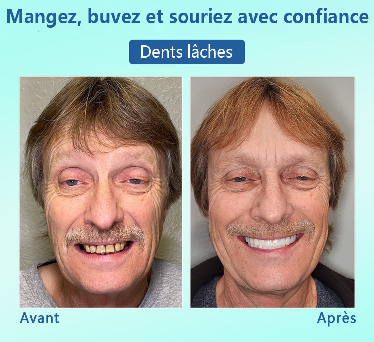 🦷DIYSTAR™ 🍀 𝐏𝐫𝐨𝐭𝐡𝐞̀𝐬𝐞 𝐃𝐞𝐧𝐭𝐚𝐢𝐫𝐞 𝐇𝐚𝐮𝐭 𝐝𝐞 𝐆𝐚𝐦𝐦𝐞 (🦷 Remise limitée dans le temps — dernières 30 minutes ! 🦷)