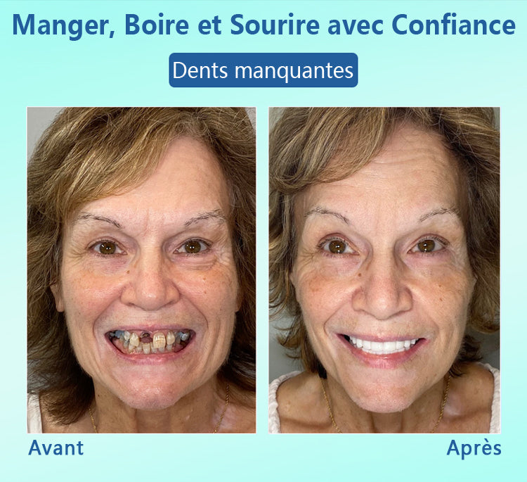 🦷DIYSTAR™ 🍀 𝐏𝐫𝐨𝐭𝐡𝐞̀𝐬𝐞 𝐃𝐞𝐧𝐭𝐚𝐢𝐫𝐞 𝐇𝐚𝐮𝐭 𝐝𝐞 𝐆𝐚𝐦𝐦𝐞 (🦷 Remise limitée dans le temps — dernières 30 minutes ! 🦷)
