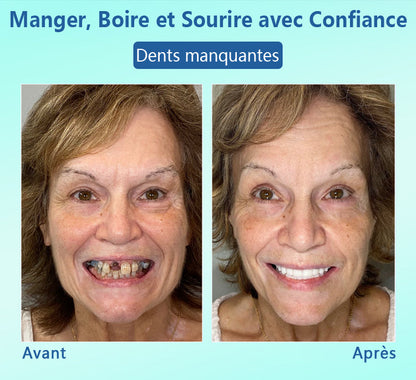 🦷DIYSTAR™ 🍀 𝐏𝐫𝐨𝐭𝐡𝐞̀𝐬𝐞 𝐃𝐞𝐧𝐭𝐚𝐢𝐫𝐞 𝐇𝐚𝐮𝐭 𝐝𝐞 𝐆𝐚𝐦𝐦𝐞 (🦷 Remise limitée dans le temps — dernières 30 minutes ! 🦷)