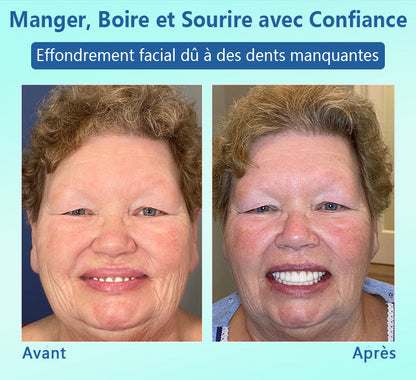 🦷DIYSTAR™ 🍀 𝐏𝐫𝐨𝐭𝐡𝐞̀𝐬𝐞 𝐃𝐞𝐧𝐭𝐚𝐢𝐫𝐞 𝐇𝐚𝐮𝐭 𝐝𝐞 𝐆𝐚𝐦𝐦𝐞 (🦷 Remise limitée dans le temps — dernières 30 minutes ! 🦷)
