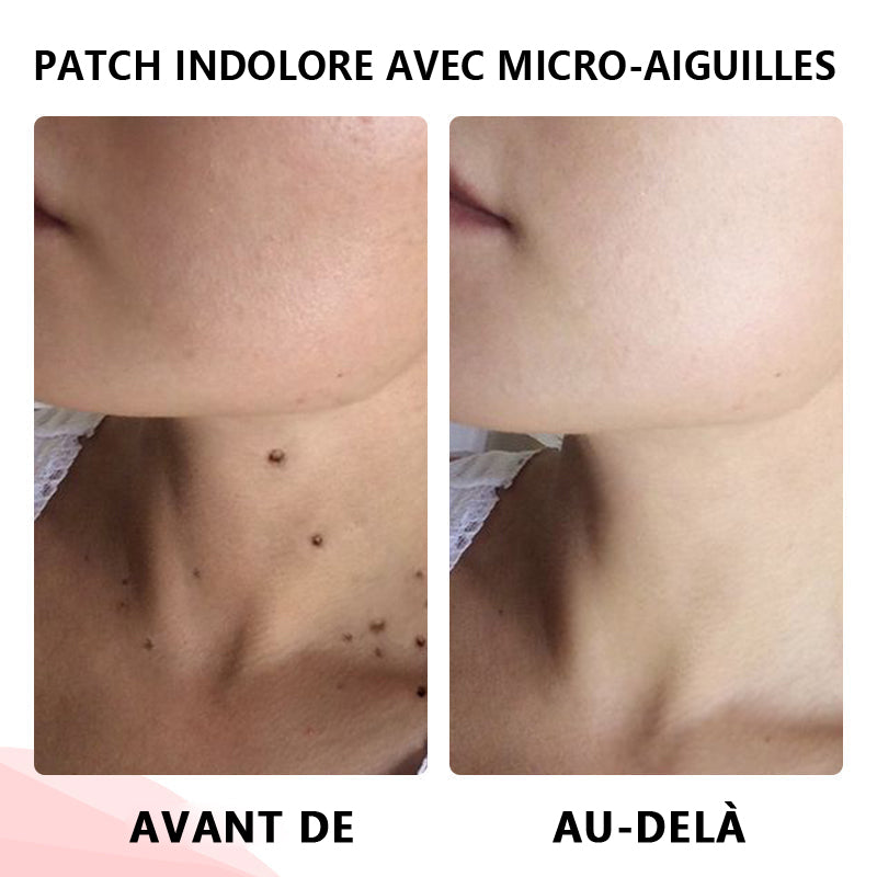 🔥ODALIT™Le patch sans douleur, ultra-efficace🔥