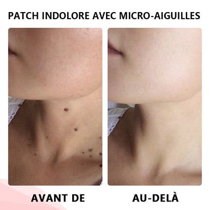 🔥ODALIT™Le patch sans douleur, ultra-efficace🔥
